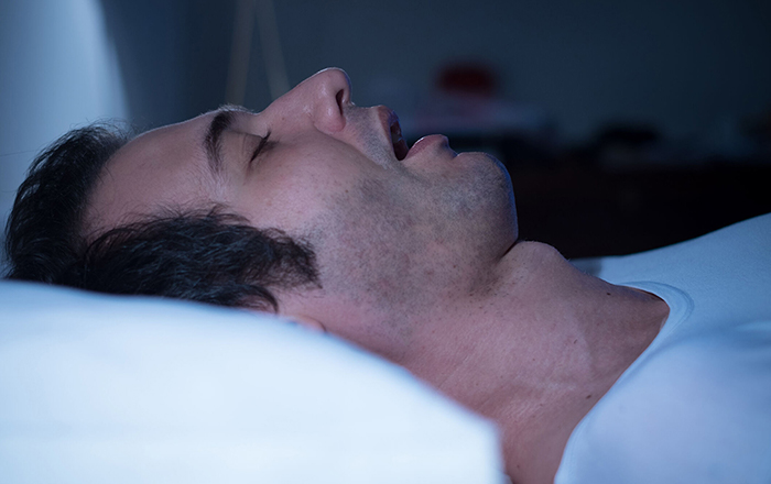 ¿Roncar es un síntoma de apnea del sueño?